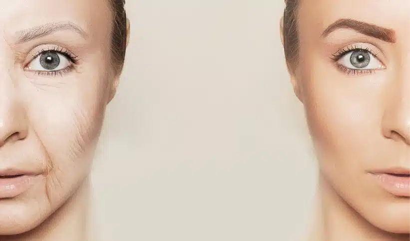 Relâchement du visage : ses causes et ses solutions